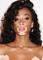 Winnie Harlow nude