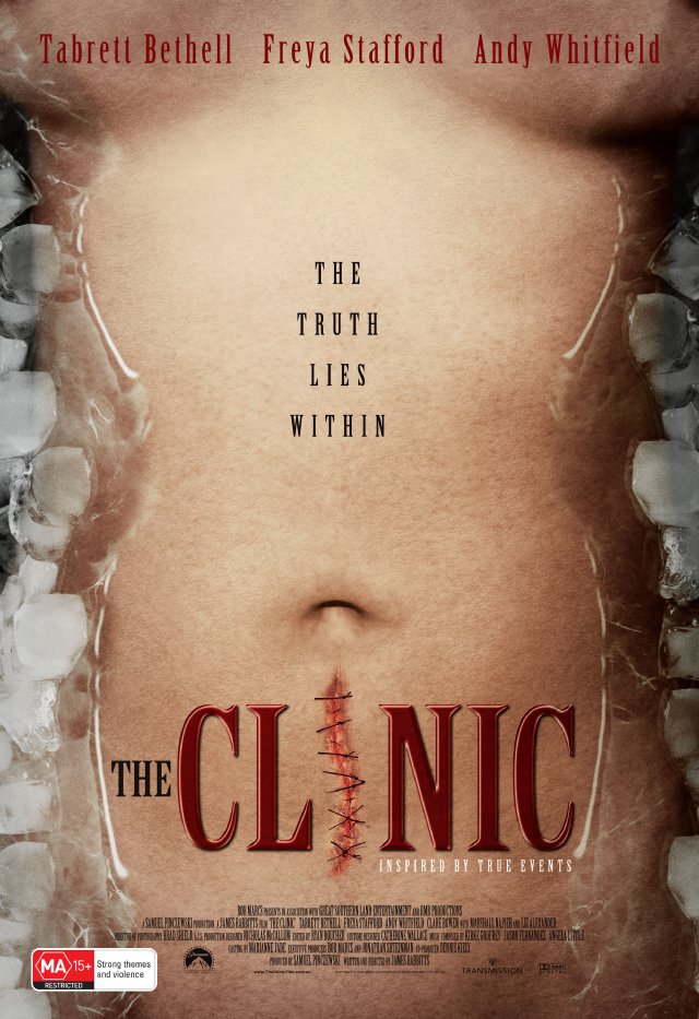 The Clinic movie nude scenes